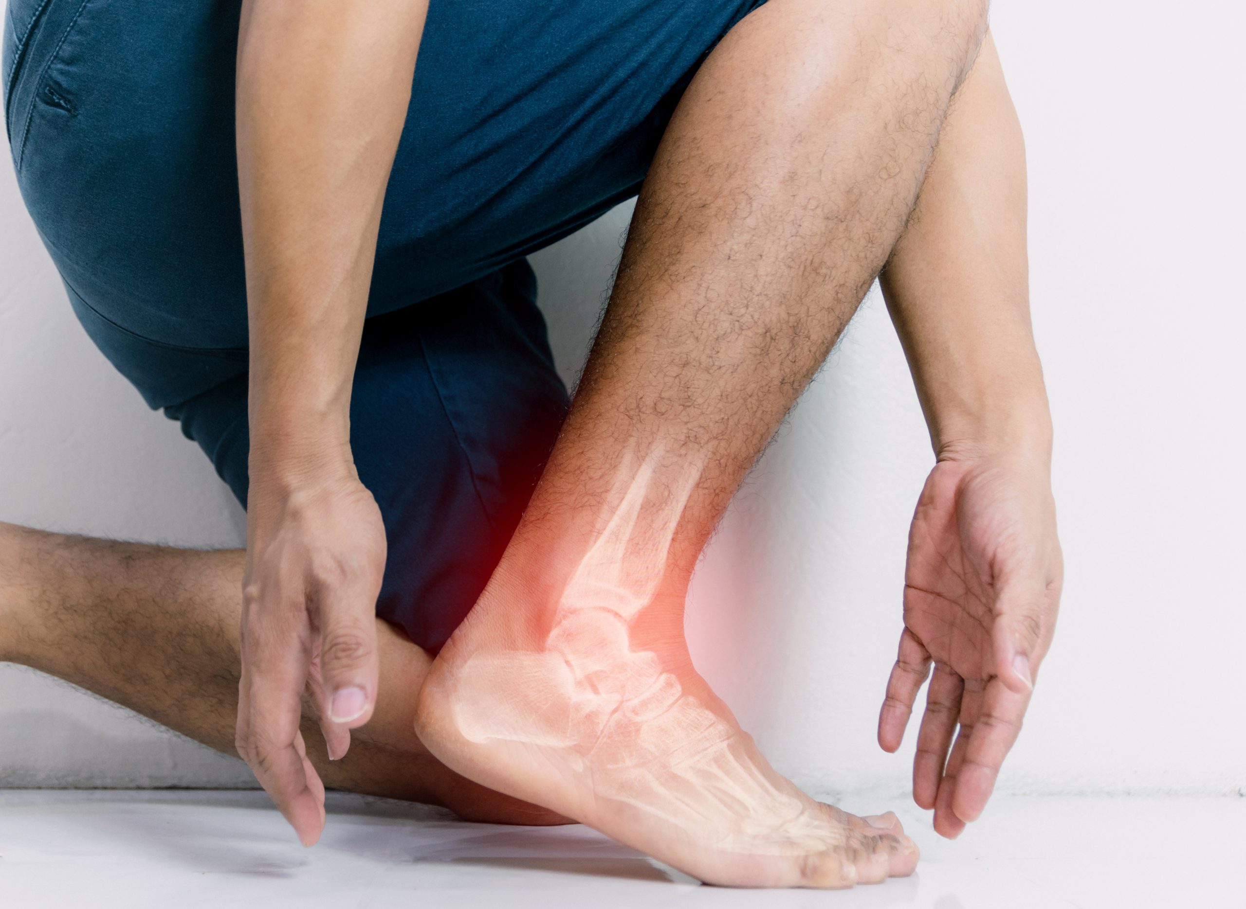 Why Information on Gout Is Vital?