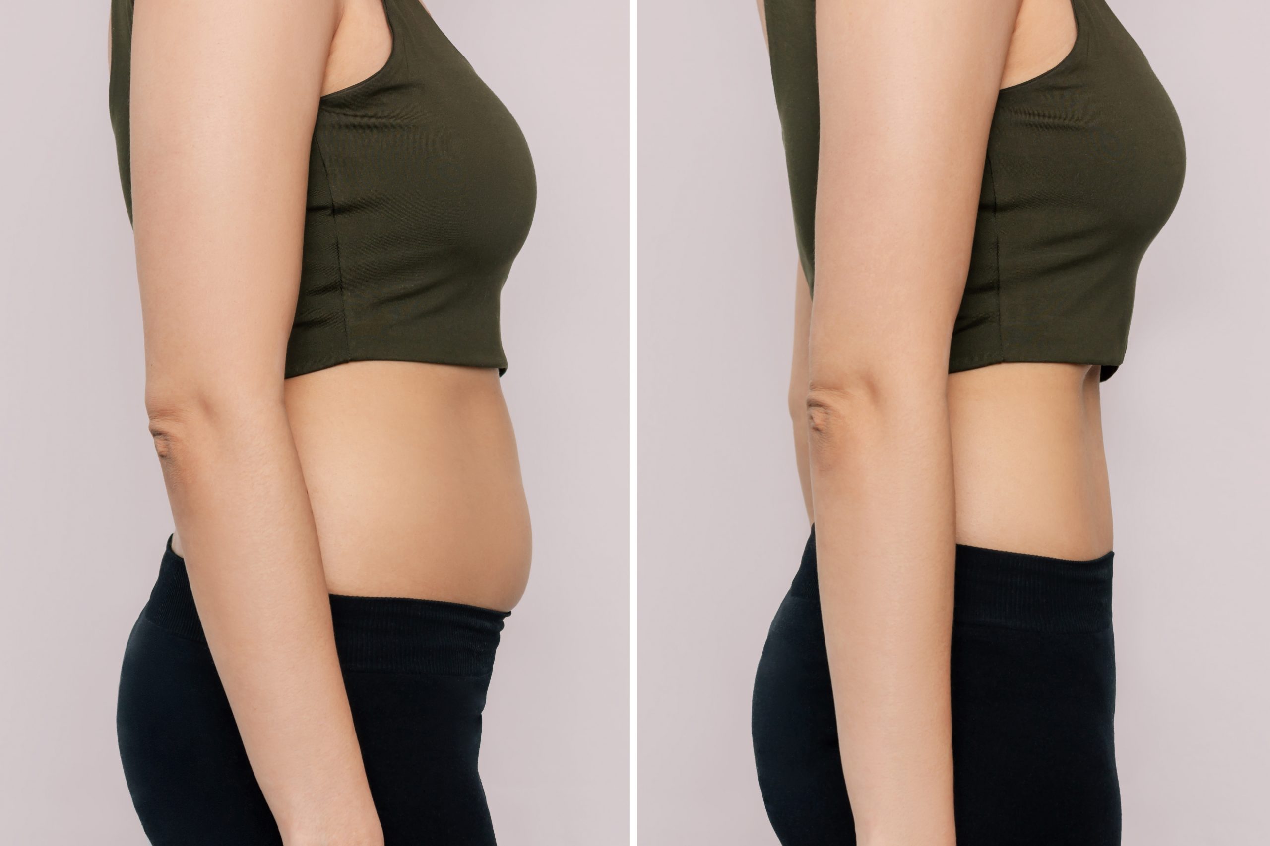 Reduslim: Lose Weight On Your Belly Now Made Easy!
