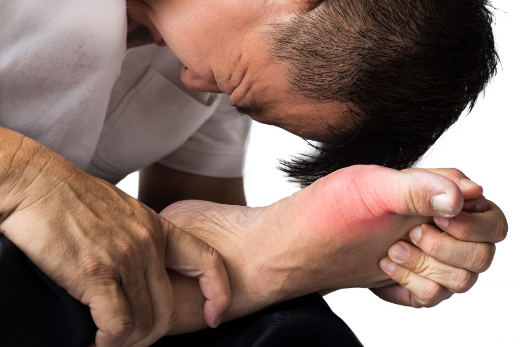 What is Gout? Symptoms and Causes